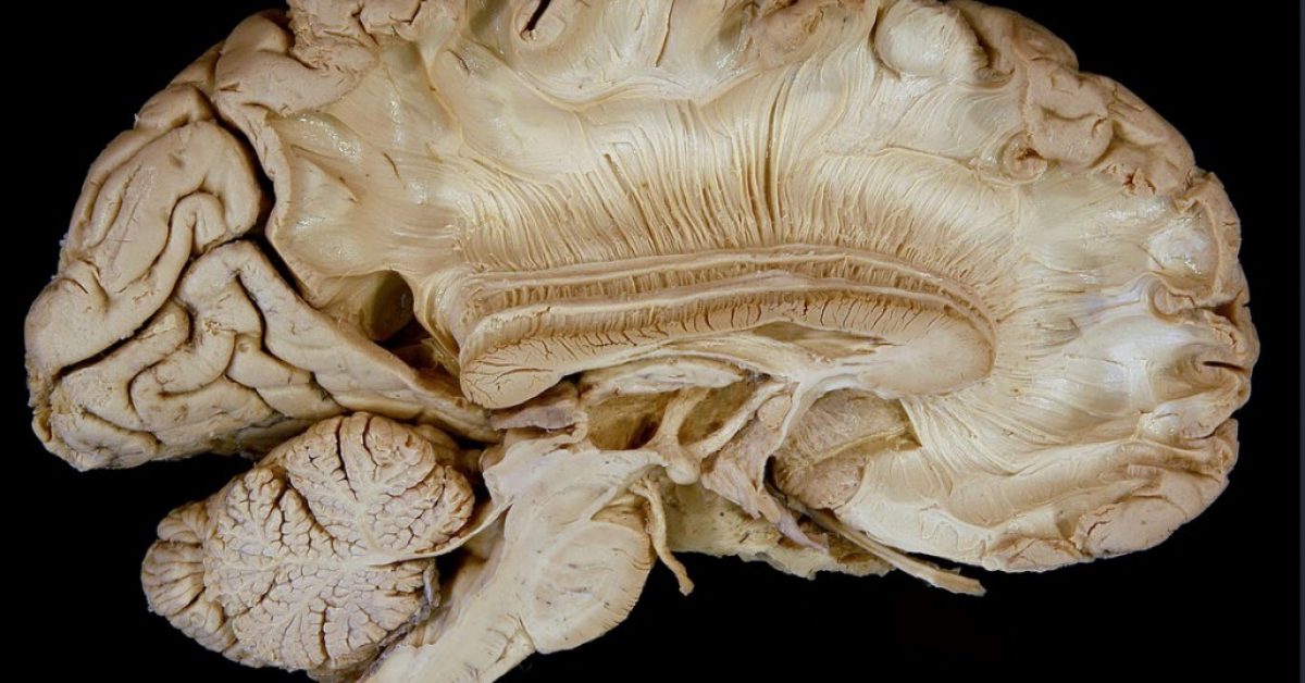 Annotation 2025-06-10 183617